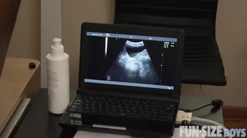 Ecografia durante il sesso anale