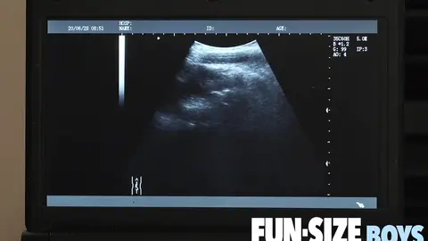 AUSTIN Episode 19 - Anal X-Ray Vision