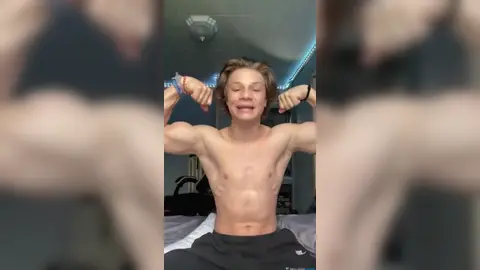 Alpha joven — pies & degradación (comp)